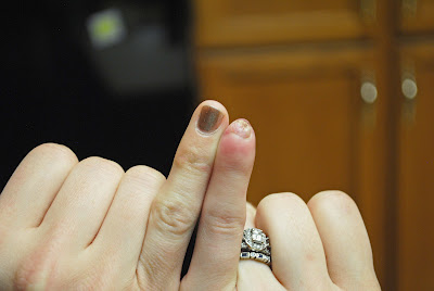 Tricia's finger 014